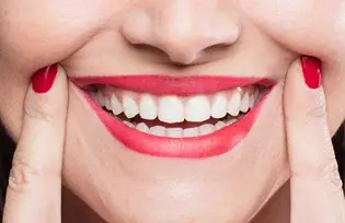 طرح لبخند کلینیک دنیای لبخند